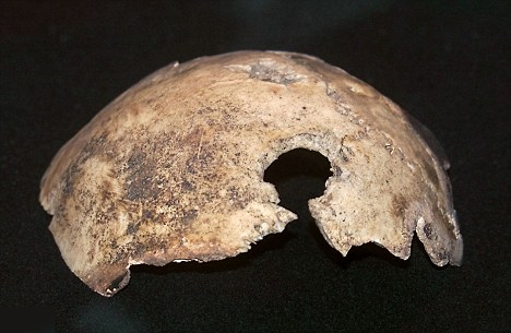 Фрагмент черепа Адольфа Гитлера, находящийся в хранилищах ФСБ